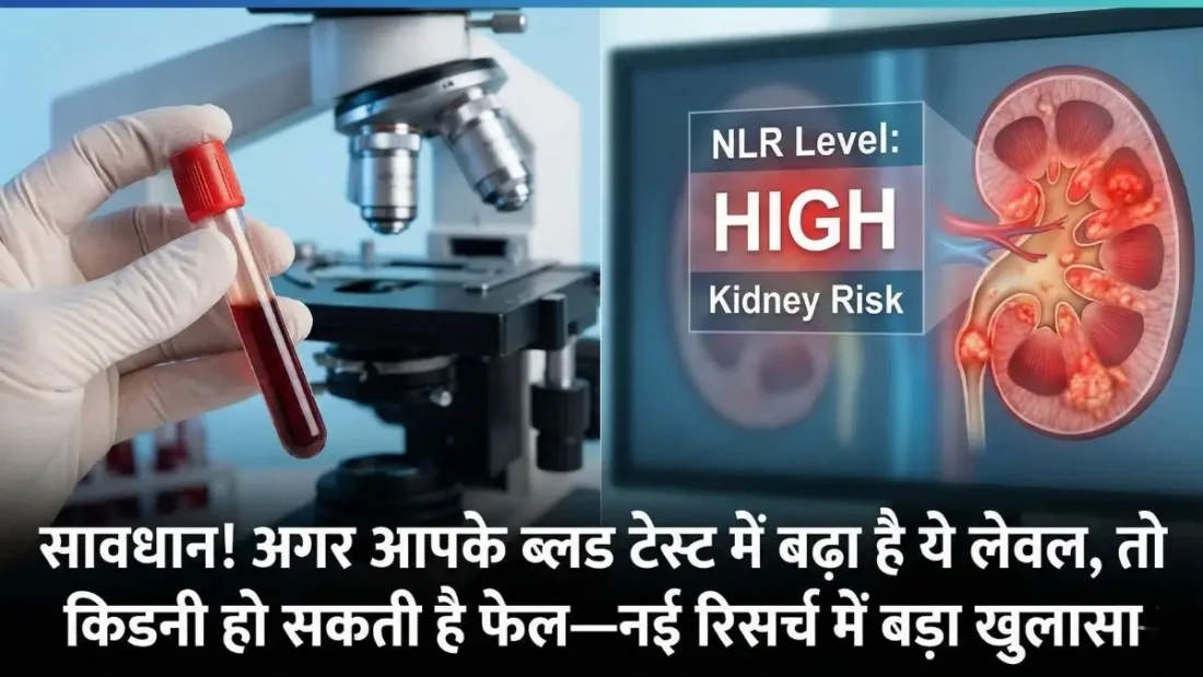 सावधान! अगर आपके ब्लड टेस्ट में बढ़ा है ये लेवल, तो किडनी हो सकती है फेल—नई रिसर्च में बड़ा खुलासा सावधान! अगर आपके ब्लड टेस्ट में बढ़ा है ये लेवल, तो किडनी हो सकती है फेल—नई रिसर्च में बड़ा खुलासा